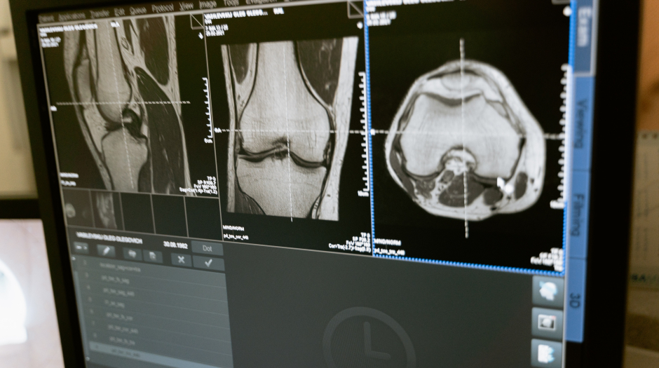 What is Interventional Radiology (IR)?
